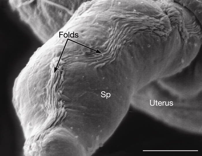 SomaticFIG 2B&C Transmission electron micrograph images of the DTC